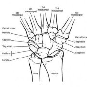 Wrist Joint Osteoarthritis