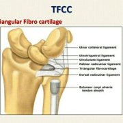 Triangular Fibrocartilage Complex (TFCC) Injuries